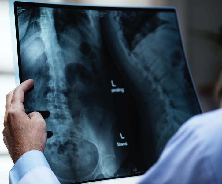 NHS Doctor looking at an X-Ray